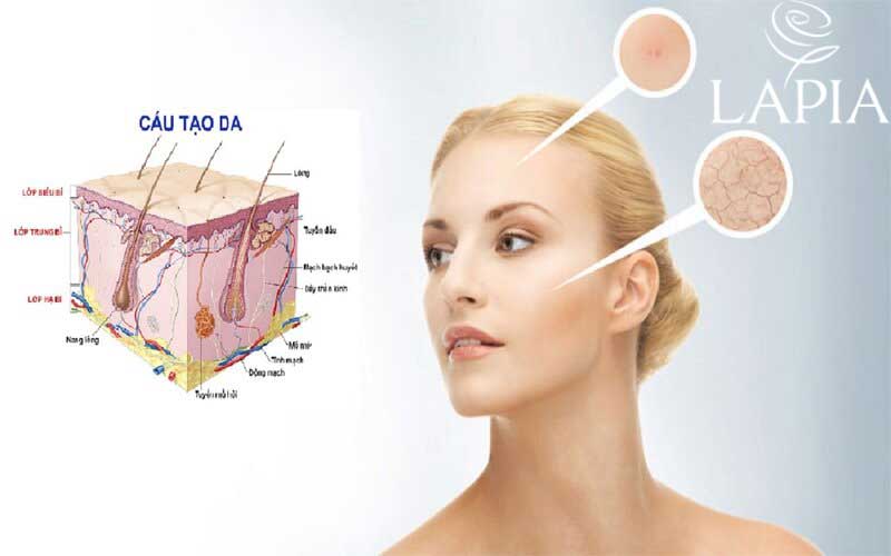 Da mặt thường mỏng và nhạy cảm hơn da toàn thân